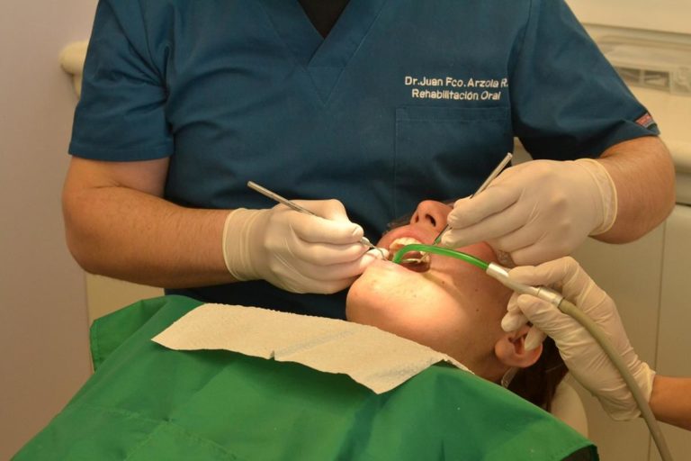 Zastanawiasz się nad wykonaniem implantów twoich zębów